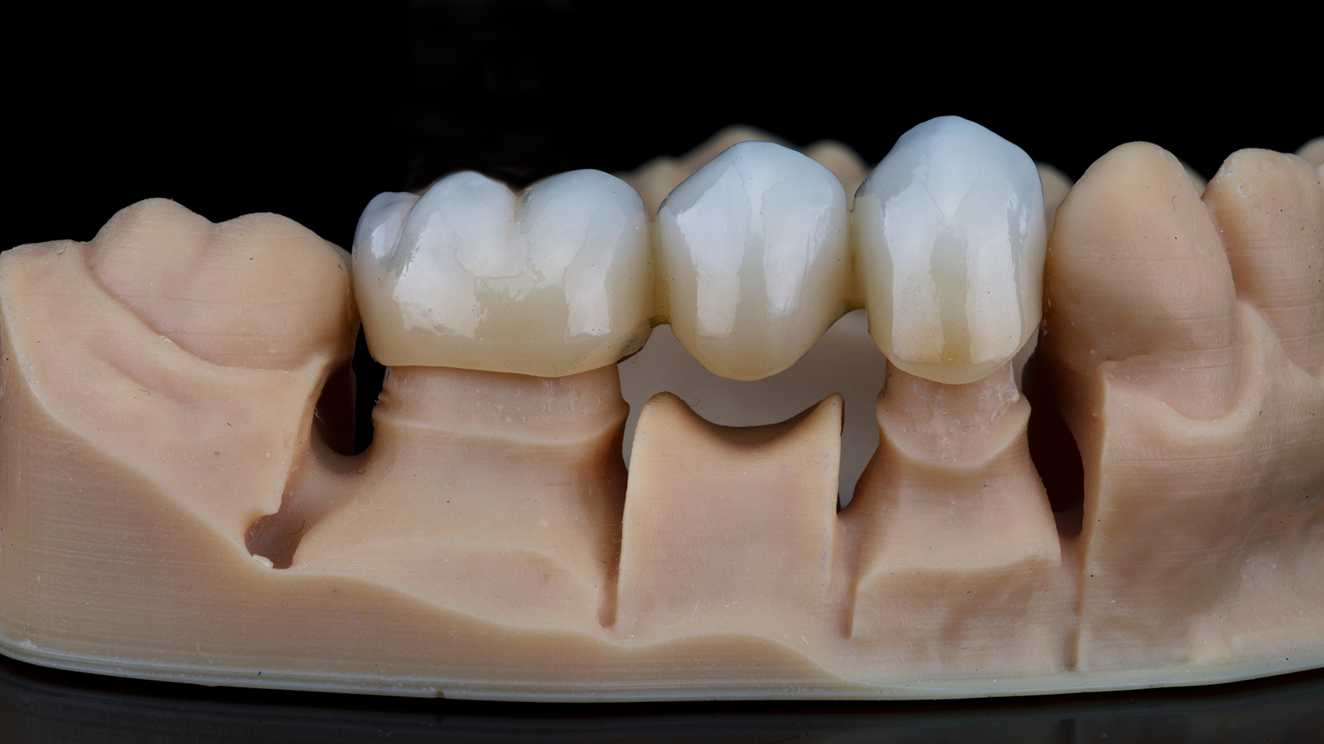 Mountain View Dentistry | Oral Exams, Dental Sealants and Dental Cleanings