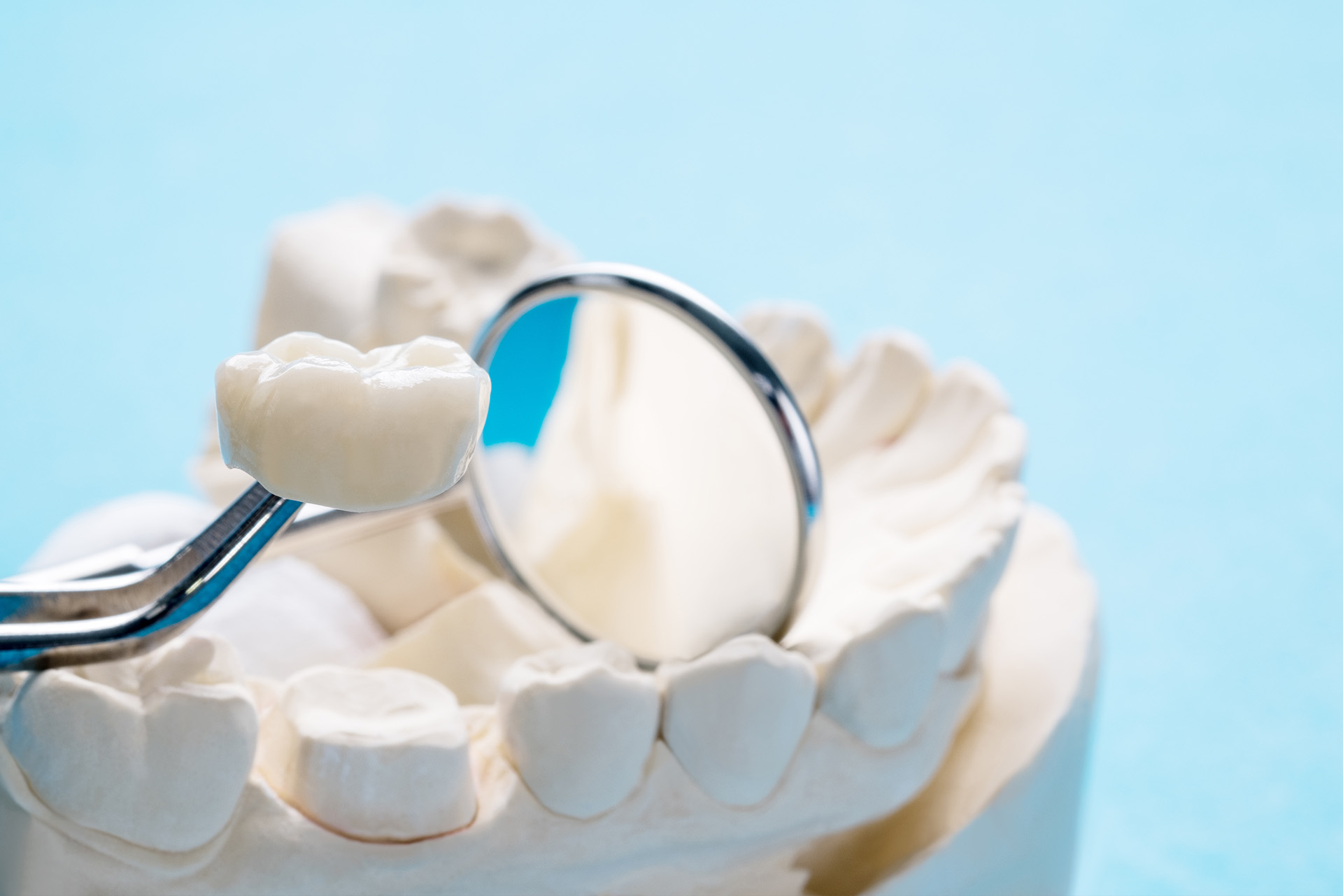 Mountain View Dentistry | Extractions, Emergency Treatment and Crowns  amp  Caps