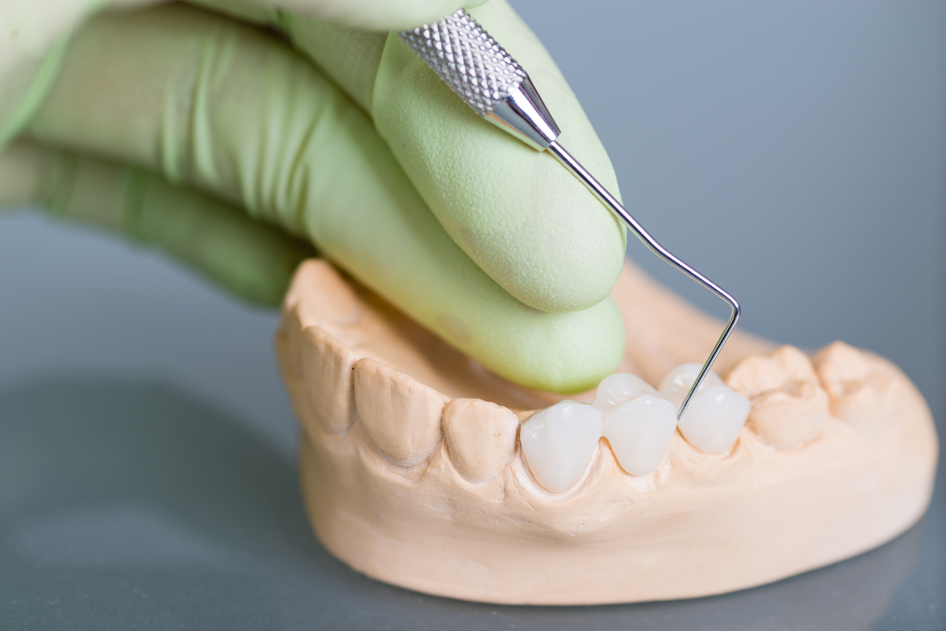 Mountain View Dentistry | Extractions, Night Guards and Dental Cleanings