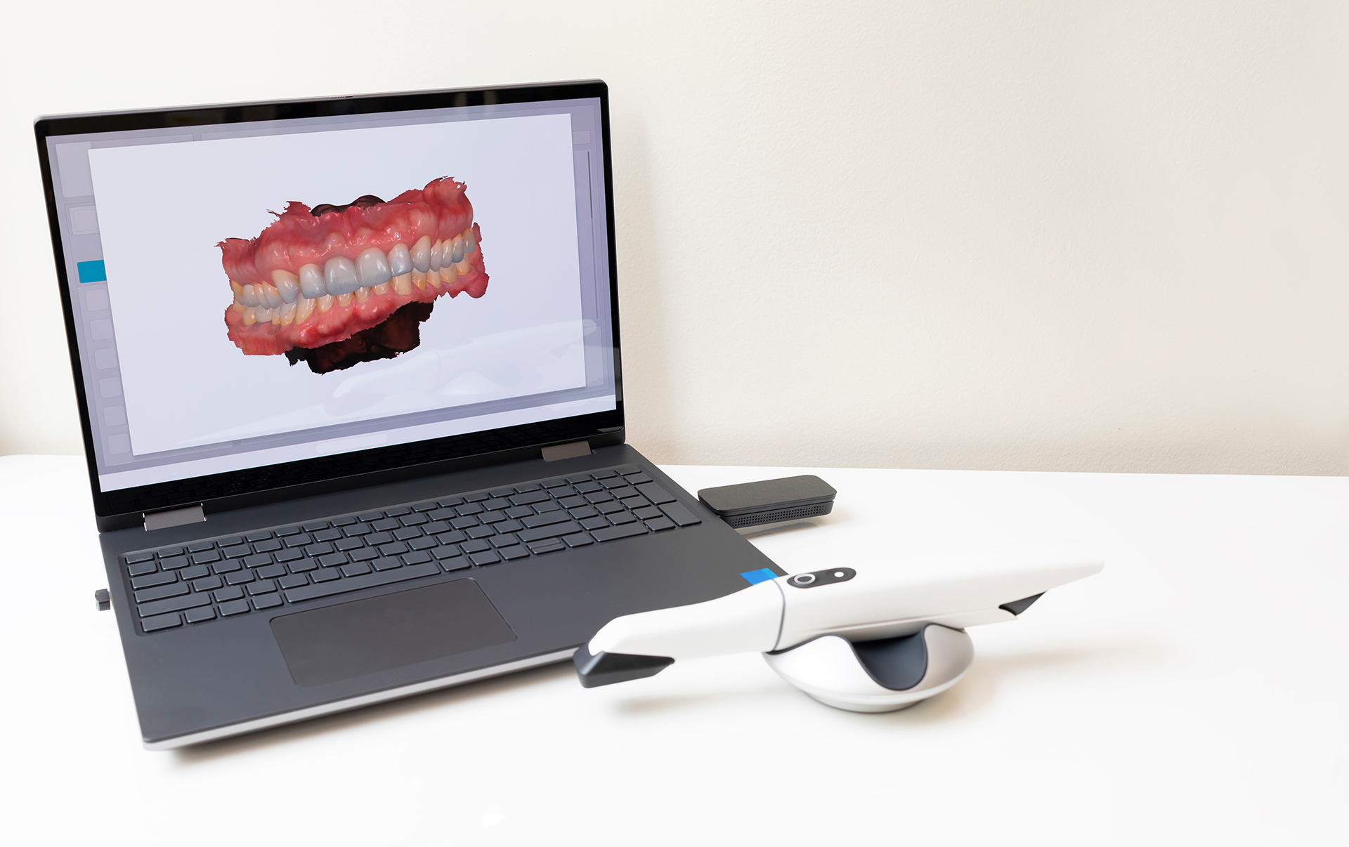 Mountain View Dentistry | Dentures, Oral Exams and Dental Fillings