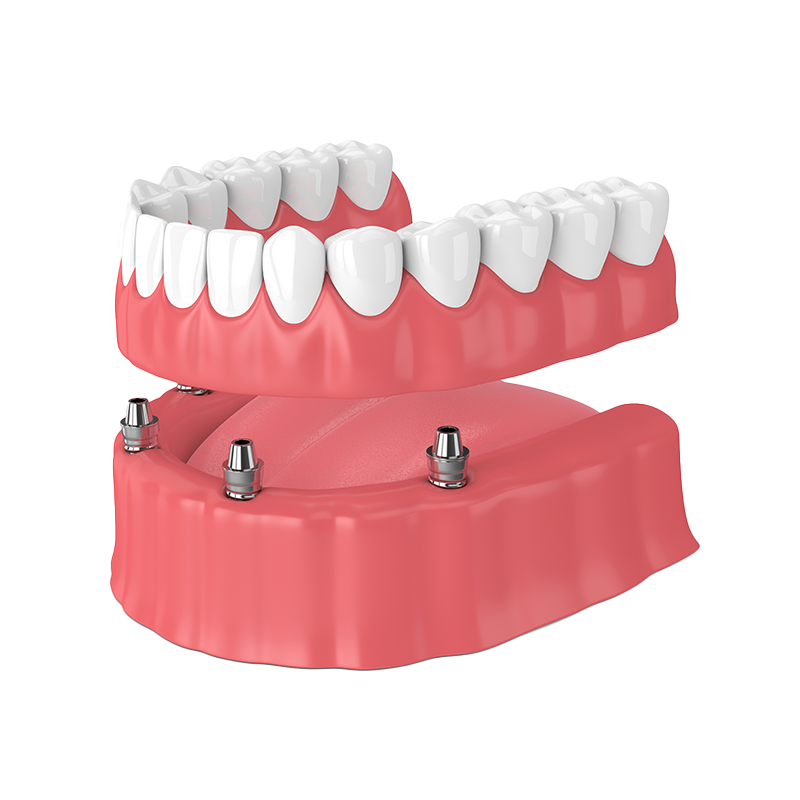 Mountain View Dentistry | Emergency Treatment, Dentures and Implant Restorations