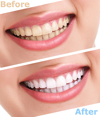 Mountain View Dentistry | Extractions, Emergency Treatment and Implant Dentistry